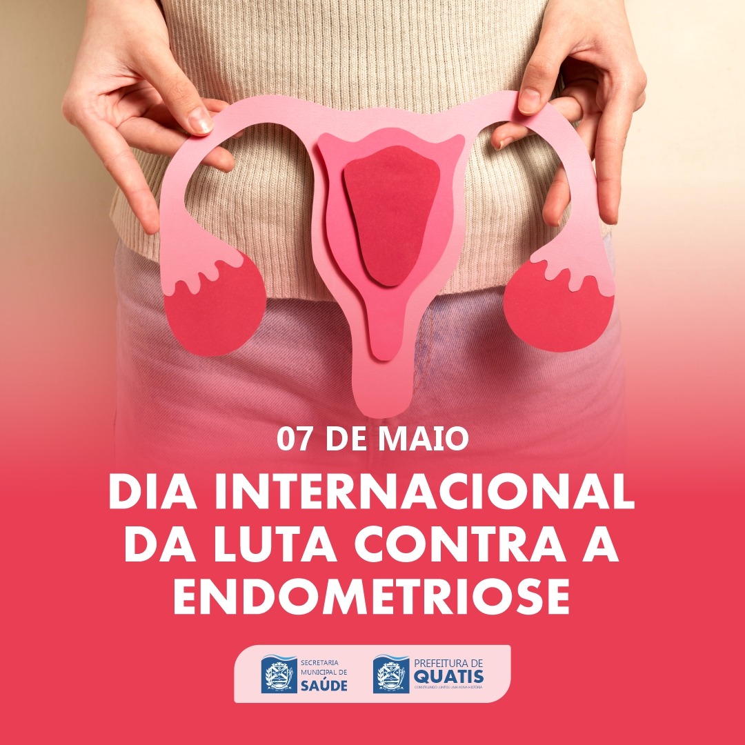 7 DE MAIO - DIA INTERNACIONAL DA LUTA CONTRA A ENDOMETRIOSE ...